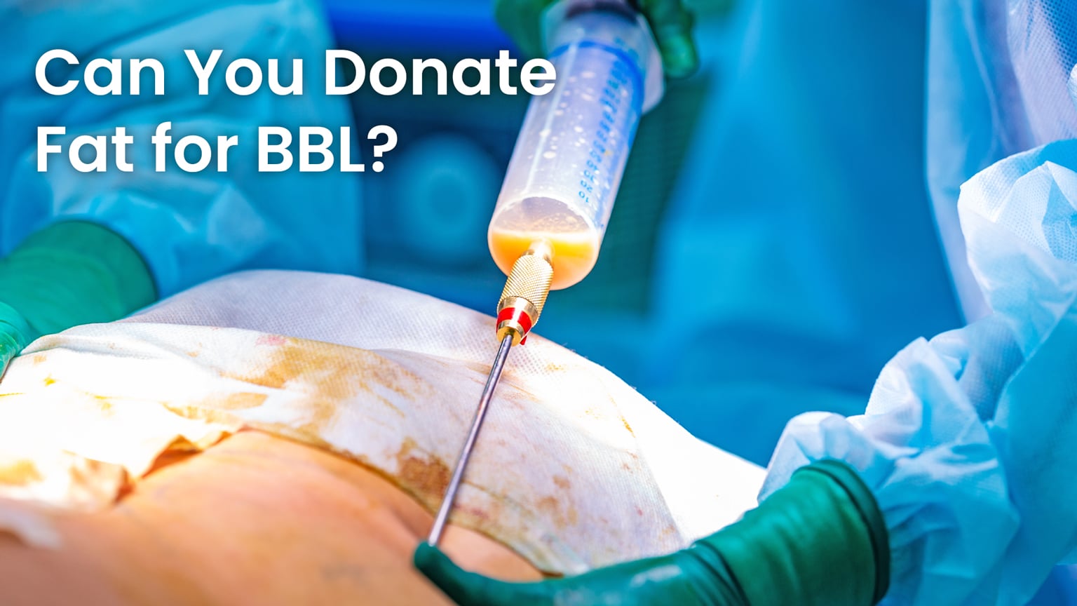 Can You Donate fat for BBL?