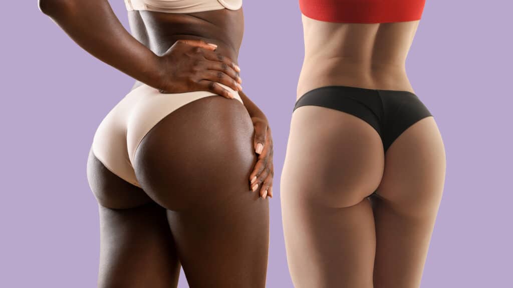 A Brazilian butt lift (BBL) is a surgical procedure that involves transferring fat from one area of the body to the buttocks to improve their shape and size. There is no specific procedure called a "natural BBL" surgery. However, some plastic surgeons may use the term to refer to a BBL procedure that uses a smaller fat volume or is designed to create a more subtle, natural-looking result.