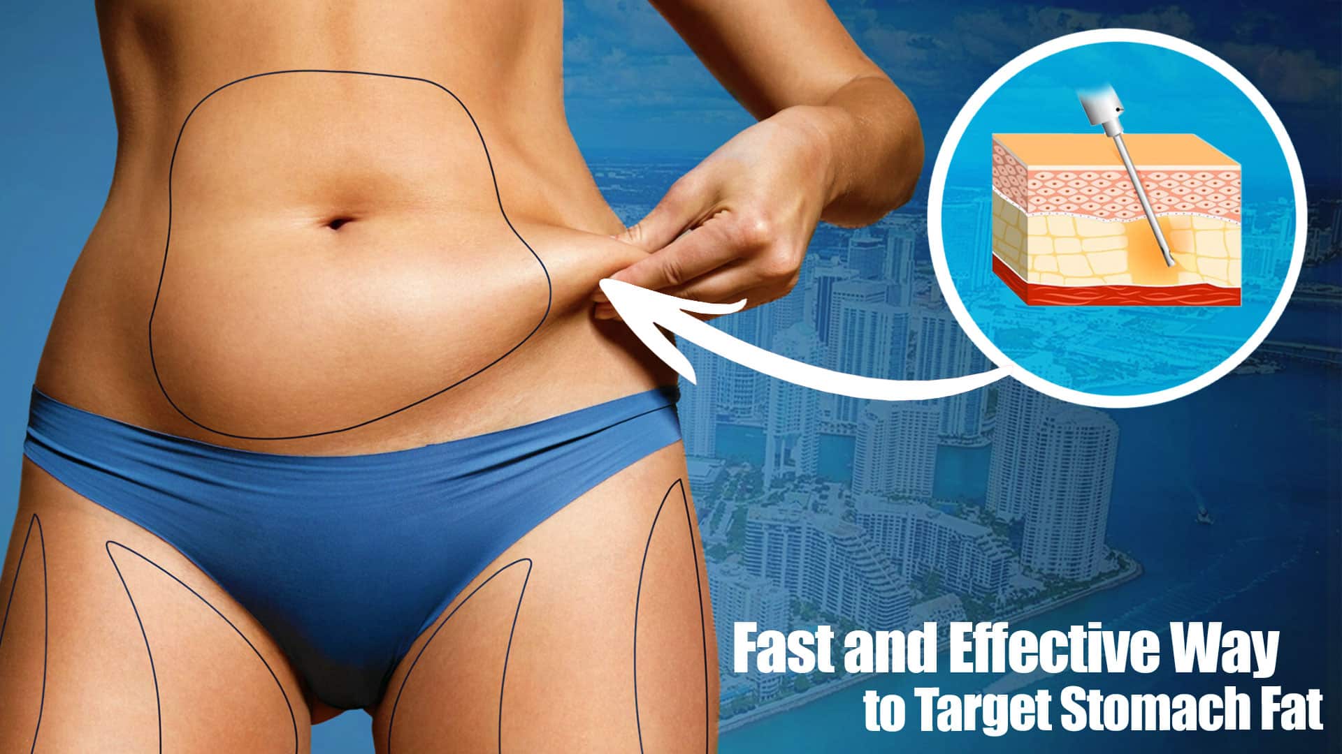 "Liposuction - The Fast and Effective Way to Target Stomach Fat"