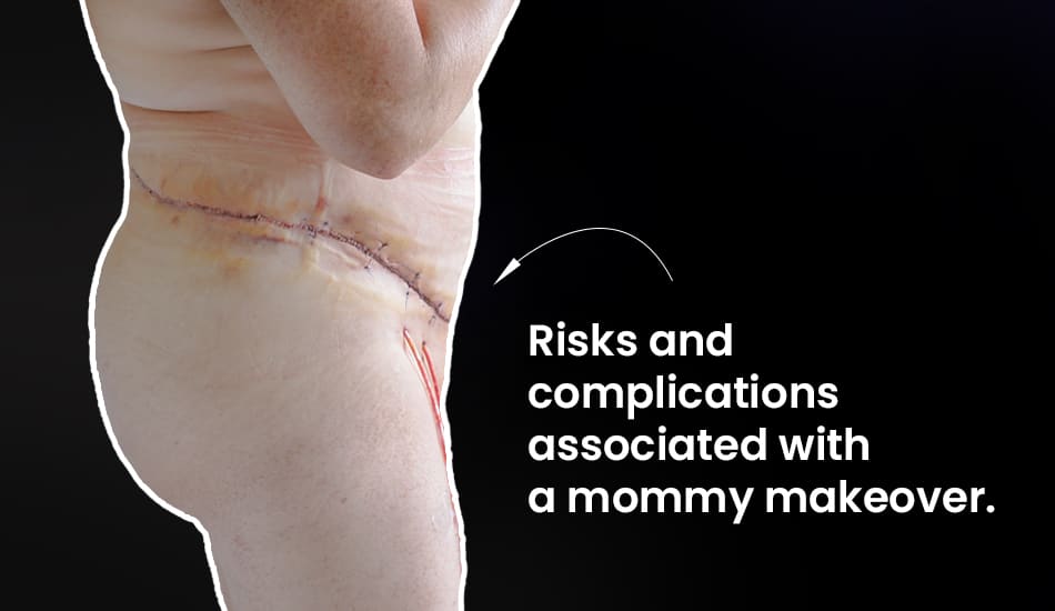 risks and complications associated with a mommy makeover