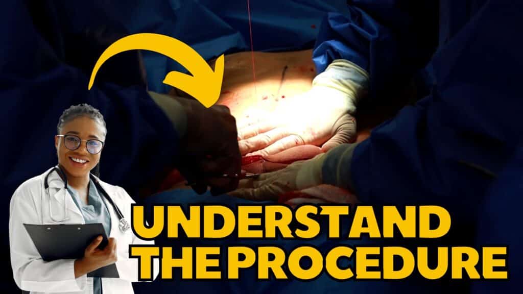 Understanding the Procedure