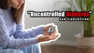 "Uncontrolled Diabetes" Caption: A person holding a glucose meter with a worried expression on their face, showing that uncontrolled diabetes is not ideal for liposuction.