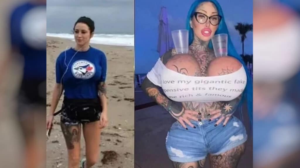 A woman who is known as an Instagram model is reportedly undergoing the process of removing all of her surgical enhancements