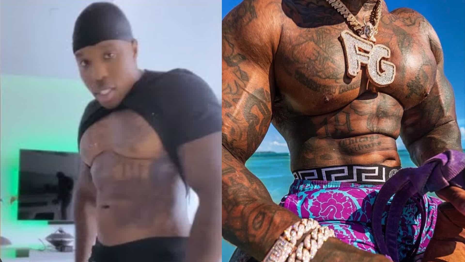 Bandman Kevo Got Liposuction