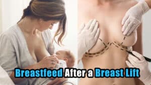 Can I Breastfeed After a Breast Lift Procedure? Tips for Recovery and Post-Operative Care