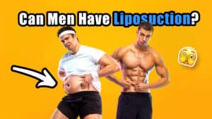 Can Men Have Liposuction? 5 Surprising Benefits of Liposuction for Men