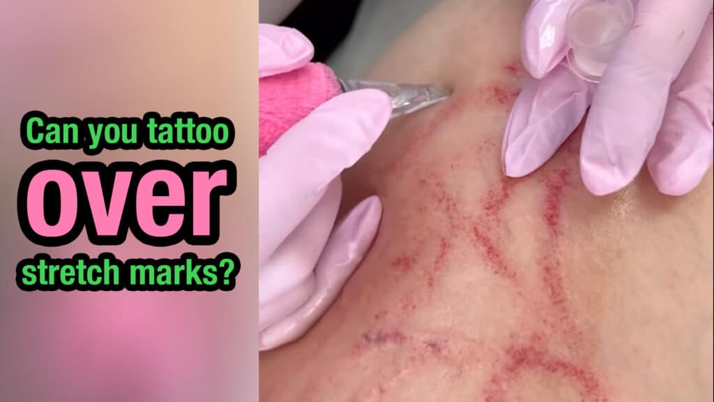 Can-you-tattoo-over-stretch-marks-