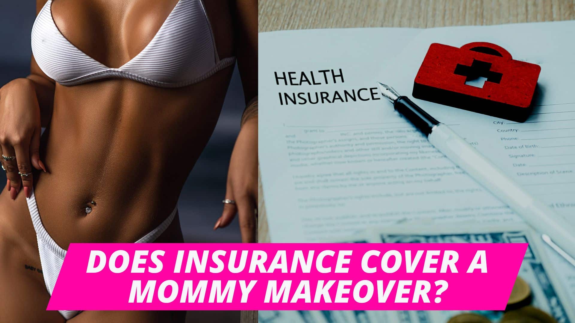 Does insurance cover a mommy makeover