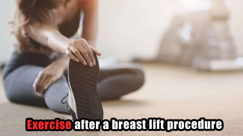 Exercise-after-a-breast-lift-procedure