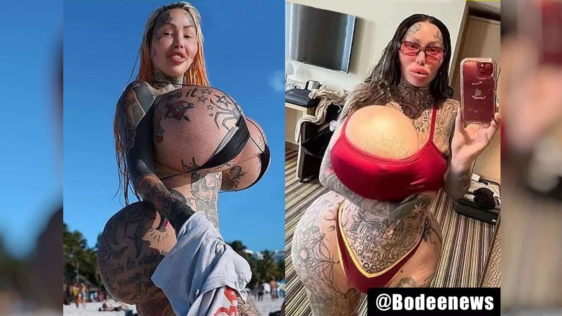 Instagram Model Deeply Regrets Extreme Surgical Enhancements