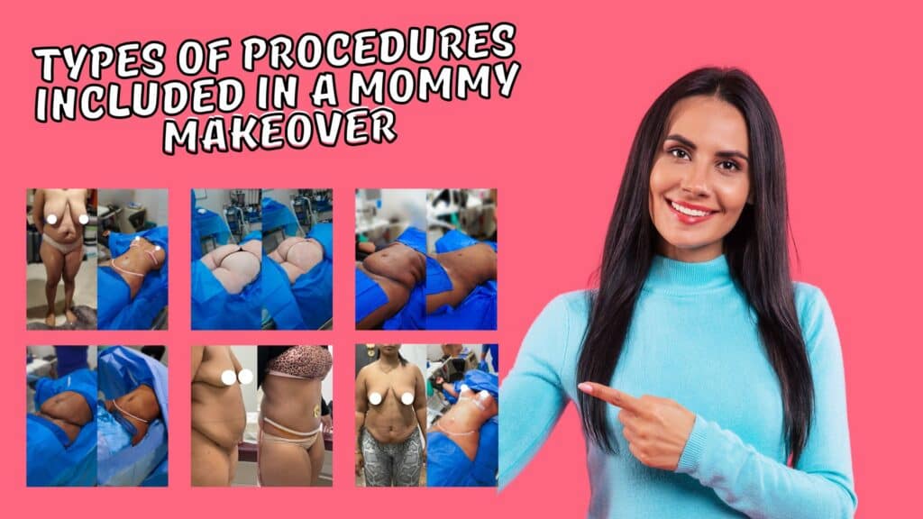 Types of procedures included in a Mommy Makeover