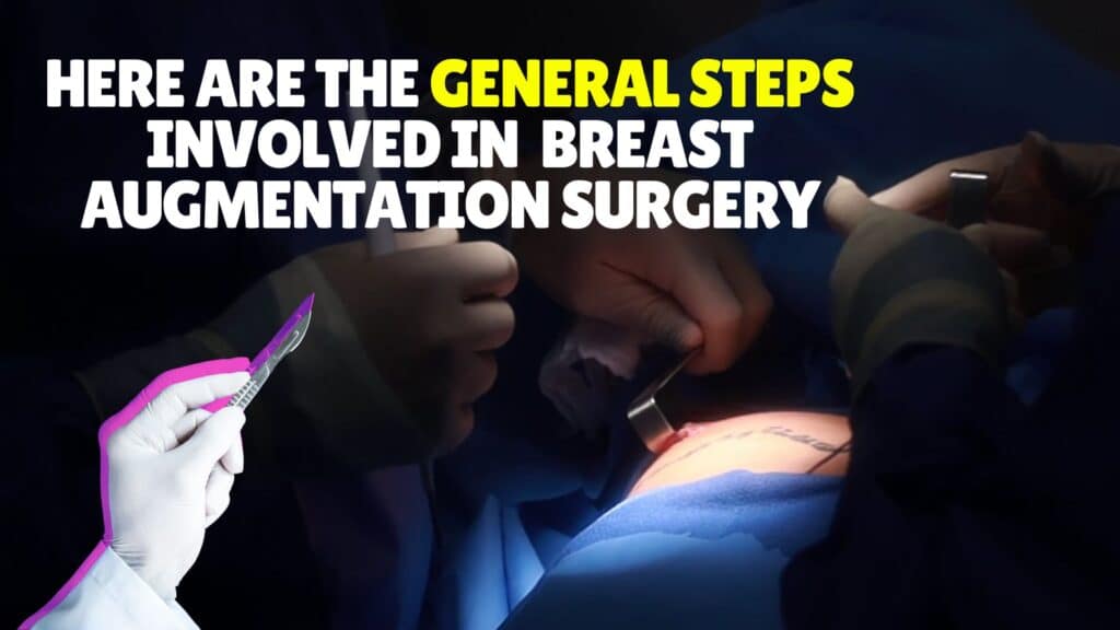 How is Breast Augmentation Performed Here are the general steps involved in breast augmentation surgery