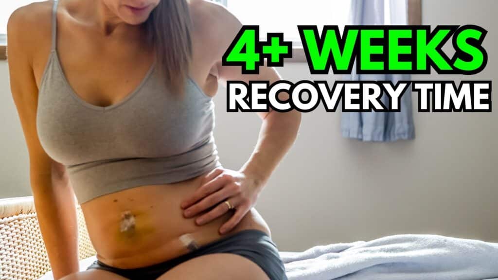 How long does it take to recover from a tummy tuck surgery?