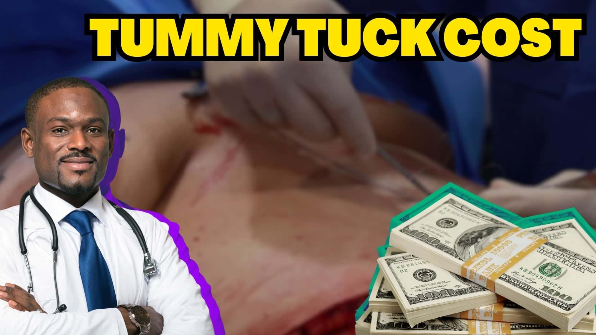 Tummy Tuck Cost: 7 Eye-Opening Truths You Need to Know to Avoid Being Overcharged!