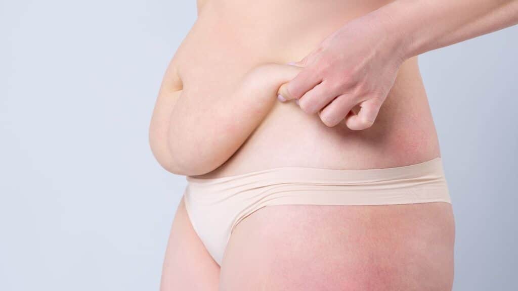 What factors affect the success of a tummy tuck surgery?