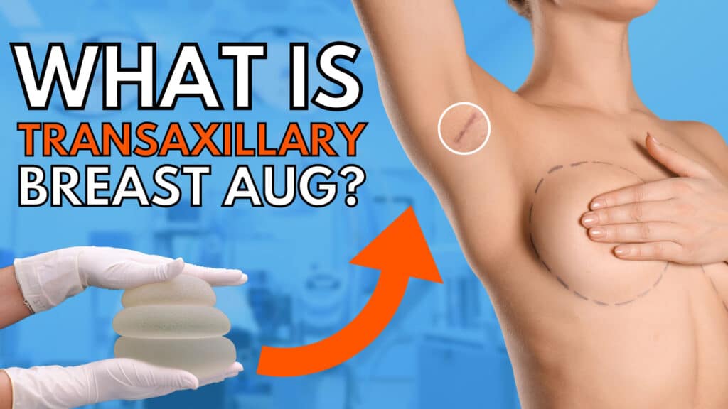 What-is-Transaxillary-breast-augmentation