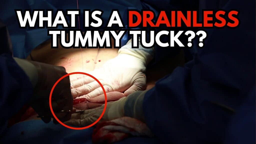 What is a drainless tummy tuck