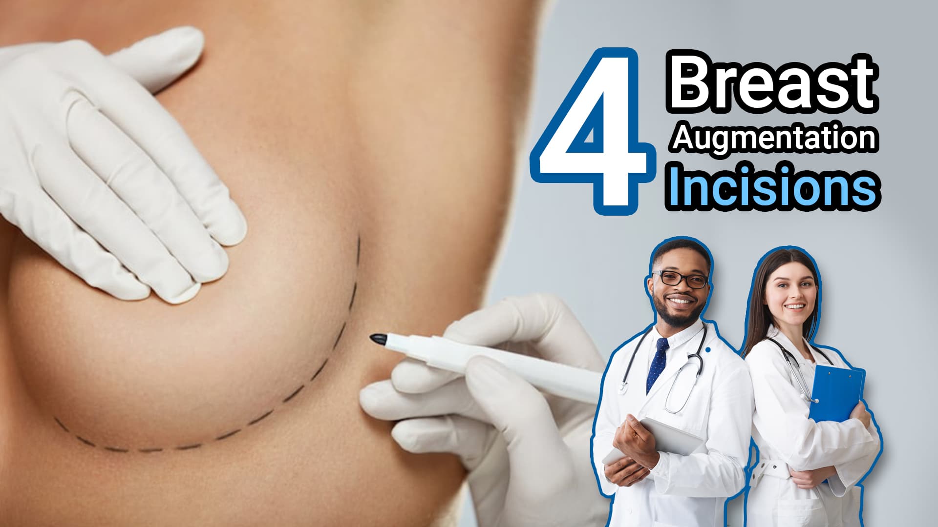 breast-augmentation-incisions