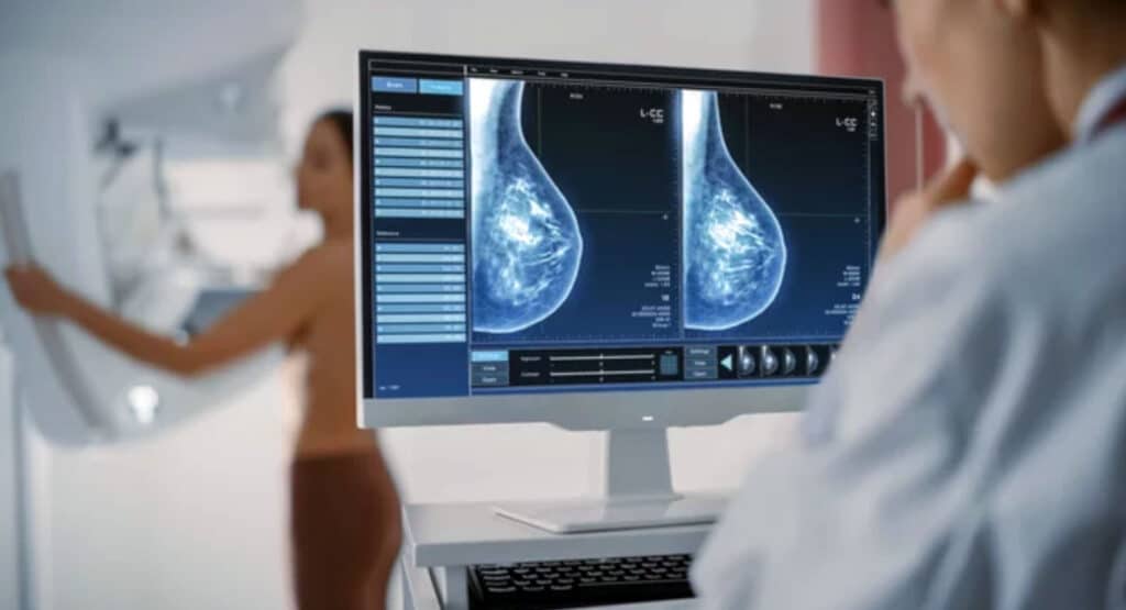 Computer Screen in Hospital Radiology Room: Beautiful Multiethnic Adult Woman Standing Topless Undergoing Mammography Screening Procedure.