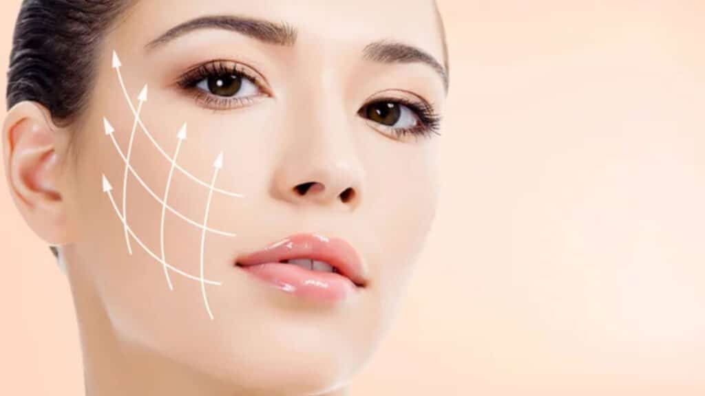 facelift-surgery questions about facelifts