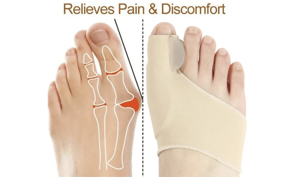 Feet Bone Thumb Adjuster Correction